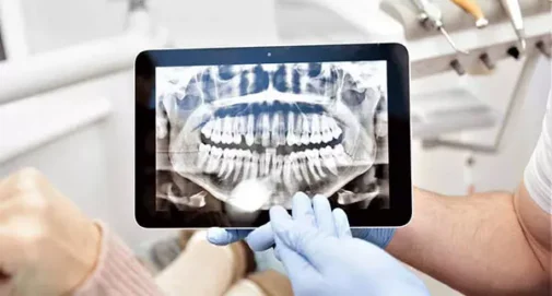 digital-xray-dental2