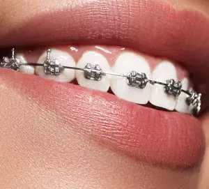 ortodonti-ankara